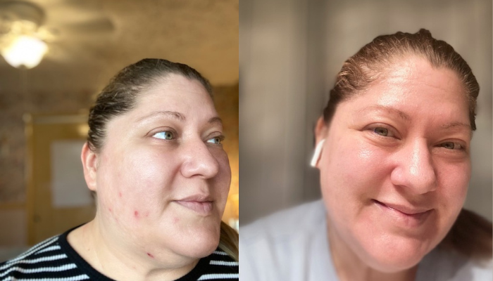 The Ultimate Skincare Guide for Midlife Women: My Daily Routine for Glowing, Healthy Skin from Dull, Acne Prone Skin.